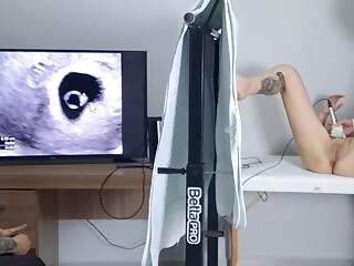 Cuckold takes wife to have an ultrasound!